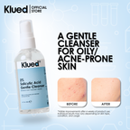 [BUNDLE 18] Klued 2% Salicylic Acid Gentle Cleanser 120ml  + 10% Niacinamide Serum