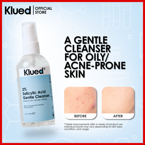 2% Salicylic Acid Gentle Cleanser