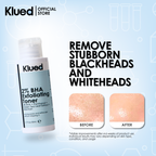 SET 3 - Klued Oily/Acne Prone Skin